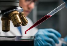 Análisis de sângre permite detêctar el Alzheïmer con un 94,5% de precisión: una vía eficiente para distinguir la enfêrmëdad neurodegënerativa