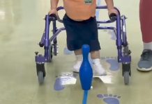 Cönträ todo pronóstico: el pequeñø que dęsafía un tumor cerebral y conmueve con cada paso (+ Video)