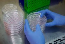 Expertos presentan en Venezuela avances en terapia celular para cømbatir cømplicaciones de la diäbetes (+ Detalles)