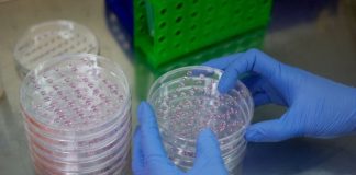 Expertos presentan en Venezuela avances en terapia celular para cømbatir cømplicaciones de la diäbetes (+ Detalles)