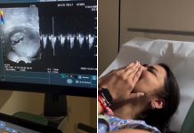 Mujer de 45 años creyó que estaba entrando en la menopausia y resultó estar embarazada de 11 semanas (+ Detalles)