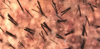 Nuevo estudio revoluciona lo que se sabía sobre el crecimiento del cabello y cuestiona teoría clásica aceptada durante décadas científicas