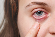 Señal de êstrés: Si tu ojo tiêmbla con frecuencia, es alêrta de que tienes tênsión acumulada