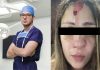 ¡Escándalo! Acüsan al “cirujano de los famosos” Froilán Páez de no ser profesional: pacientes denüncian presunta mala praxis y desfigüraciones (+ Fotos)
