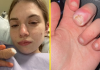 Una joven de 21 años estuvo a punto de perder un dedo por una infêcción causada por mørderse las uñas (+ Detalles)