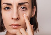 La secreción ocular y amanecer con el ojo pegado son síntomas de infeccïón y no de alergïa