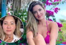 Modelo colombiana Daniela Álvarez reveló que debe someterse a una biøpsia por la reaparición de un nódulo en su cuello (+ Detalles)