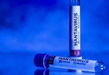 España, Francia y Países Bajos adquieren un tratamiento experimental contra el hant@virus (+ Detalles)