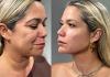 Ciencia y longevidad celular: La era regenerativa transforma los paradigmas de la armonización facial y el cuidado de la piel (+ Detalles)