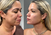 Ciencia y longevidad celular: La era regenerativa transforma los paradigmas de la armonización facial y el cuidado de la piel (+ Detalles)