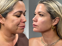 Ciencia y longevidad celular: La era regenerativa transforma los paradigmas de la armonización facial y el cuidado de la piel (+ Detalles)