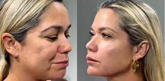Ciencia y longevidad celular: La era regenerativa transforma los paradigmas de la armonización facial y el cuidado de la piel (+ Detalles)