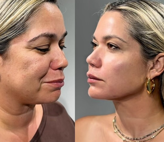 Ciencia y longevidad celular: La era regenerativa transforma los paradigmas de la armonización facial y el cuidado de la piel (+ Detalles)