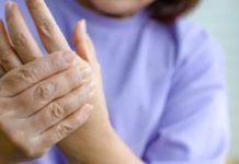 Cuando una articulación se inflâma, le llamamos artritïs, la artrøsis aparece a medida que vamos creciendo, según expertos