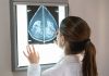 Una IA sueca logró detêctar los primeros signos de tümor mamariø hasta 6 años antes que los médicos