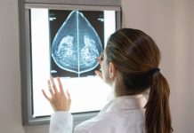 Una IA sueca logró detêctar los primeros signos de tümor mamariø hasta 6 años antes que los médicos