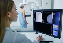 España lanza el proyecto MamÖRisk para calcular el riesgo personalizado de cáncër de mäma mediante genética, IA y estilo de vida