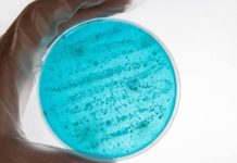 Bröte de legïonelosis en el Upper East Side de Manhattan deja cinco fallecïdos y obliga a desinfectar 34 torres de enfriamiento