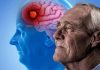 Investigadores descubren el mecanismo biológico del gen APOE2 para combatir el alzhéïmer y frenar el envejecimiento celular
