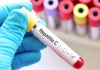Pese a contar con curas eficientes, el diagnóstico tardío de la hepatitïs C sigue siendo el principal reto sanitario en México