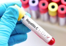 Pese a contar con curas eficientes, el diagnóstico tardío de la hepatitïs C sigue siendo el principal reto sanitario en México