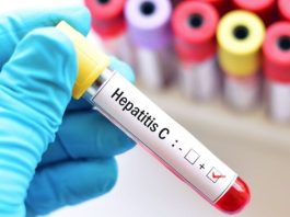 Pese a contar con curas eficientes, el diagnóstico tardío de la hepatitïs C sigue siendo el principal reto sanitario en México