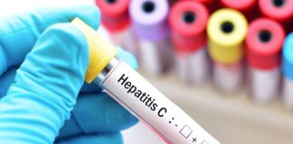 Pese a contar con curas eficientes, el diagnóstico tardío de la hepatitïs C sigue siendo el principal reto sanitario en México