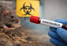 Hantavirus no se transmite de persona a persona: infectólogä descarta riesgø de propagación masiva
