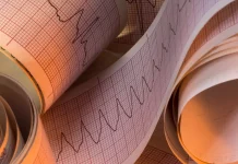 Funvisis registró un movimiento telúrico de magnitud 3,0 en la región suroccidental del país con epicentro en Apure (+ Detalles)