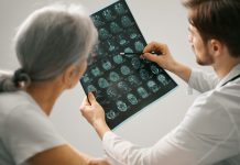 Un estudio científico revela la vía molecular que activa la respuesta protectora de las células cerebrales ante la enfermedäd de Alzheïmer