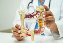 Extender el plazo de las colonoscopias de seguimiento permitirá optimizar recursos de salud y reducir molestïas a pacientes