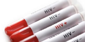 EE.UU. reducirá gradualmente su ayuda contra el VIH en Namibia para pasar a un modelo de cooperación técnica