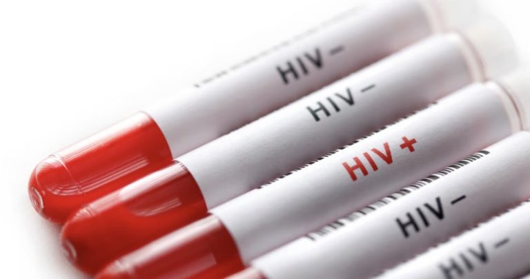EE.UU. reducirá gradualmente su ayuda contra el VIH en Namibia para pasar a un modelo de cooperación técnica