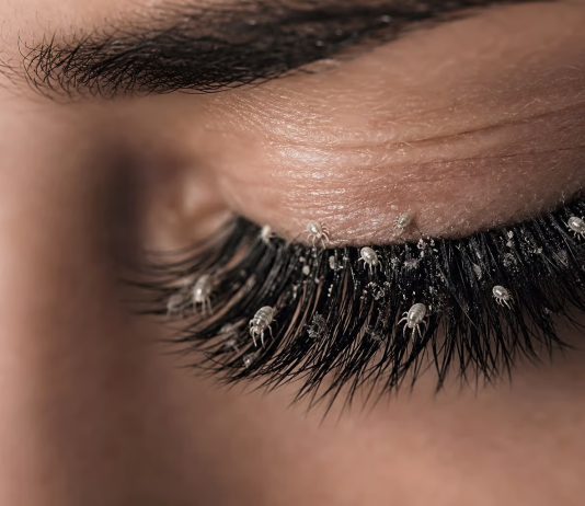 Estudio revela la presencia de ácaros microscópicos en el 96% de las mujeres con extensiones de pestañas
