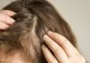 Estudio científico revela que un medicamento para la artritis logra restaurar el cabello en casos severøs de alopecia