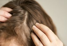 Estudio científico revela que un medicamento para la artritis logra restaurar el cabello en casos severøs de alopecia
